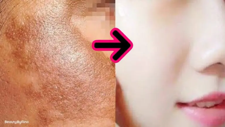Descubre cómo el jabón de azufre puede eliminar las manchas del rostro de forma efectiva